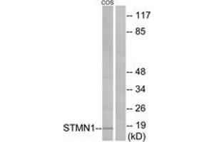 Western blot analysis of extracts from COS7 cells, treated with PMA 1ng/ml 15', using Stathmin 1 (Ab-24) Antibody. (Stathmin 1 anticorps  (AA 9-58))