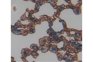 Figure. (EPHX4 anticorps  (AA 36-359))