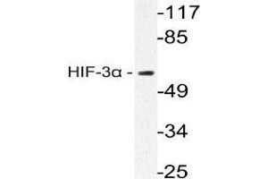 Western blot analysis of HIF3A Antibody in extracts from Rat brain cells. (HIF3A anticorps)