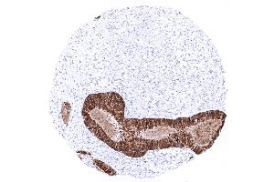 Endocervix (Recombinant Mammaglobin anticorps)