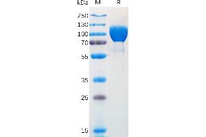 Human N Protein, hFc Tag on SDS-PAGE under reducing condition.