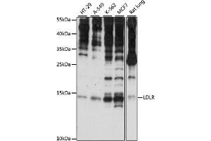 Western blot analysis of extracts of various cell lines, using SNRNP25 antibody (ABIN7270360) at 1:1000 dilution. (SNRNP25 anticorps  (AA 1-132))