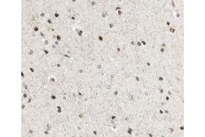 ABIN6267035 at 1/100 staining human Brain tissue sections by IHC-P.