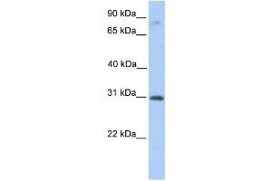 Western Blotting (WB) image for anti-Abhydrolase Domain Containing 13 (ABHD13) antibody (ABIN2459363)