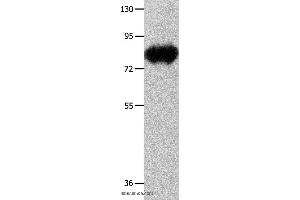Western blot analysis of Mouse heart tissue, using ECE1 Polyclonal Antibody at dilution of 1:900 (ECE1 anticorps)