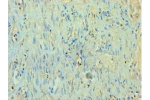 Immunohistochemistry of paraffin-embedded human epityphlon tissue using ABIN7166926 at dilution of 1:100 (TP53I3 anticorps  (AA 163-332))