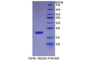 SDS-PAGE (SDS) image for High Temperature Requirement Factor A1 (AA 10-146) protein (His tag) (ABIN2121264) (High Temperature Requirement Factor A1 (AA 10-146) protein (His tag))