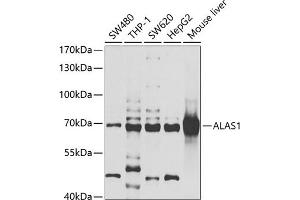 Western blot analysis of extracts of various cell lines, using  antibody (ABIN6129895, ABIN6136754, ABIN6136756 and ABIN6222177) at 1:1000 dilution. (ALAS1 anticorps  (AA 1-250))