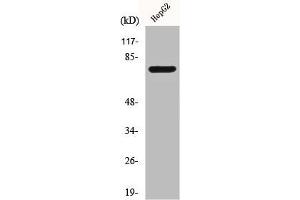 Western Blot analysis of Jurkat cells using CLIP4 Polyclonal Antibody