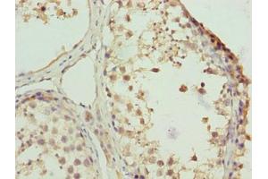 Immunohistochemistry of paraffin-embedded human testis tissue using ABIN7176109 at dilution of 1:100 (ZNF131 anticorps  (AA 80-379))