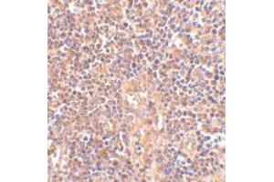 Immunohistochemistry of ATM in human lymph node tissue with ATM polyclonal antibody  at 2. (ATM anticorps  (C-Term))