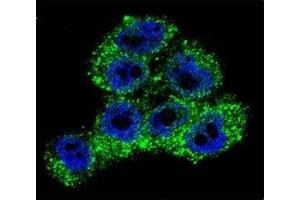 Confocal immunofluorescent analysis of TRPM8 antibody with A375 cells followed by Alexa Fluor 488-conjugated goat anti-rabbit lgG (green).