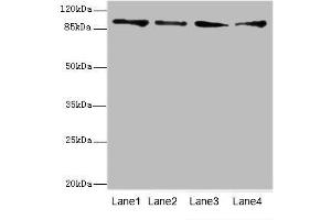 Western blot analysis of (1) HeLa whole cell lysate, (2) Mouse heart tissue, (3) HepG-2 whole cell lysate and (4) Jurkat whole cell lysate, using TNNI3K antibody (4. (TNNI3K anticorps  (AA 1-75))