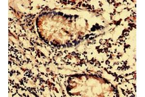 Immunohistochemistry analysis of human appendix tissue using ABIN7143903 at dilution of 1:100 (MAN2C1 anticorps  (AA 746-969))