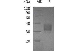 Western Blotting (WB) image for Fc Fragment of IgG, Low Affinity IIb, Receptor (CD32) (FCGR2B) protein (His tag) (ABIN7320522)