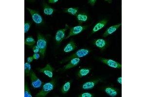 Immunofluorescent analysis of p53 staining in Hela cells.