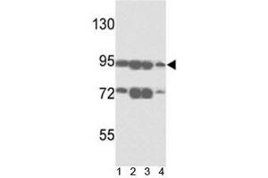 Western blot analysis of ABCB5 antibody and 1) A375, 2) K562, 3) A2058 and4)  HL-60 lysate. (ABCB5 anticorps  (AA 1-30))