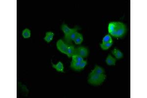 Immunofluorescence staining of MCF-7 cells with ABIN7173373 at 1:400, counter-stained with DAPI.