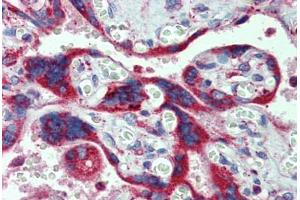 Placenta, Human: Formalin-Fixed, Paraffin-Embedded (FFPE)