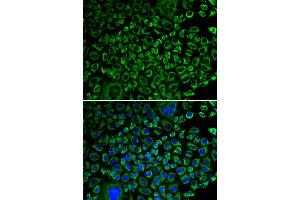Immunofluorescence analysis of A549 cells using F10 antibody (ABIN5970678). (Coagulation Factor X anticorps)