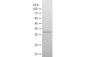 Western Blotting (WB) image for V-Ets Erythroblastosis Virus E26 Oncogene Homolog 2 (ETS2) (AA 226-469) protein (His tag) (ABIN7125680)