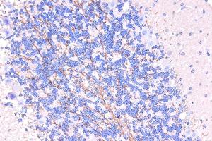 Immunohistochemistry of paraffin-embedded human brain using ARMET/ARP/MANF Rabbit pAb (ABIN6129561, ABIN6143461, ABIN6143463 and ABIN6222775) at dilution of 1:50 (40x lens). (MANF anticorps  (AA 25-182))