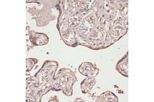 Immunohistochemistry of paraffin-embedded human placenta using Thioredoxin reductase 1 (Thioredoxin reductase 1 (TXNRD1 ) ) antibody (ABIN7270806) at dilution of 1:100 (40x lens). (TXNRD1 anticorps)