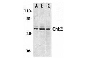 Western Blotting (WB) image for anti-Checkpoint Kinase 2 (CHEK2) (N-Term) antibody (ABIN1031318) (CHEK2 anticorps  (N-Term))
