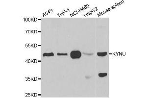 Western blot analysis of extracts of various cell lines, using KYNU antibody. (KYNU anticorps  (AA 1-307))