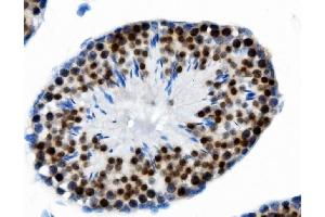 IHC analysis of PTBP2 using anti-PTBP2 antibody (ABIN7599453). (PTBP2 anticorps  (AA 1-504))