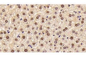 Detection of HMGB1 in Mouse Liver Tissue using Polyclonal Antibody to High Mobility Group Protein 1 (HMGB1) (HMGB1 anticorps  (AA 1-215))