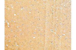 ABIN7094805 and ABIN7098856 at 1/100 staining Rat brain tissue by IHC-P. (MCT3 anticorps  (C-Term))