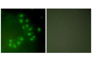 Immunofluorescence analysis of A549 cells, using p63 antibody (ABIN5976481). (TCP1 alpha/CCTA anticorps  (C-Term))