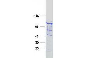 Validation with Western Blot