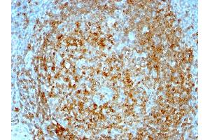 Formalin-fixed, paraffin-embedded human Tonsil stained with CD74 Mouse Monoclonal Antibody (CLIP/813). (CD74 anticorps)