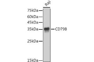 Western blot analysis of extracts of Raji cells, using CD79B antibody (ABIN1682474, ABIN3018855, ABIN3018856 and ABIN7101674) at 1:1000 dilution. (CD79b anticorps)