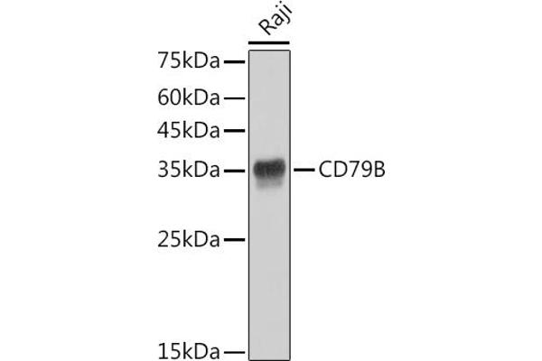 CD79b anticorps