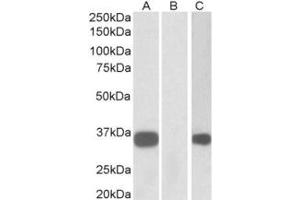 Western Blotting (WB) image for anti-Kv Channel Interacting Protein 3, Calsenilin (KCNIP3) (N-Term) antibody (ABIN2465094) (DREAM anticorps  (N-Term))