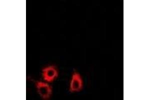 Immunofluorescence (IF) image for anti-SET and MYND Domain Containing 4 (SMYD4) (AA 1-260) antibody (ABIN6004721) (SMYD4 anticorps  (AA 1-260))