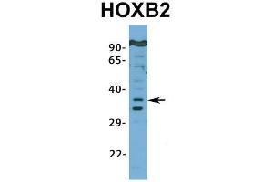 Host:  Rabbit  Target Name:  HOXB2  Sample Type:  MCF7  Antibody Dilution:  1.