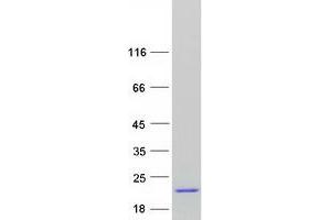 Validation with Western Blot