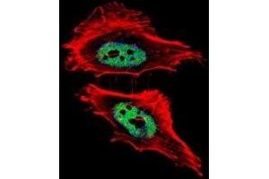 Fluorescent confocal image of HeLa cells stained with CTBP1 antibody.