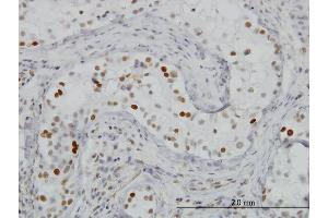 Immunoperoxidase of monoclonal antibody to BRD3 on formalin-fixed paraffin-embedded human testis.