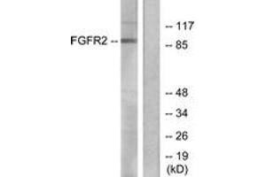 Western blot analysis of extracts from A549 cells, using FGFR2 Antibody. (FGFR2 anticorps  (AA 471-520))