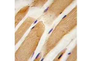 Image no. 3 for anti-Actin, Alpha, Cardiac Muscle 1 (ACTC1) (Center) antibody (ABIN357023) (ACTC1 anticorps  (Center))