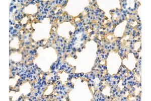 Phospho-CDK5 (Tyr239) Antibody at 1/100 staining Mouse lung tissue by IHC-P. (CDK5 anticorps  (pTyr239))