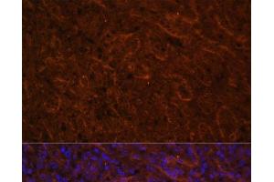 Immunofluorescence analysis of Human spleen using ICOS Polyclonal Antibody at dilution of 1:100. (ICOS anticorps)