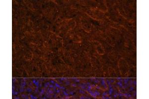 Immunofluorescence analysis of Human spleen using ICOS Polyclonal Antibody at dilution of 1:100. (ICOS anticorps)