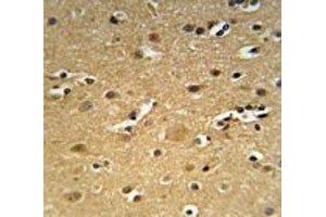 CD30 antibody immunohistochemistry analysis in formalin fixed and paraffin embedded human brain tissue.