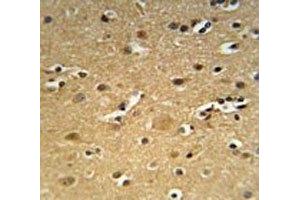 CD30 antibody immunohistochemistry analysis in formalin fixed and paraffin embedded human brain tissue. (TNFRSF8 anticorps  (AA 458-487))